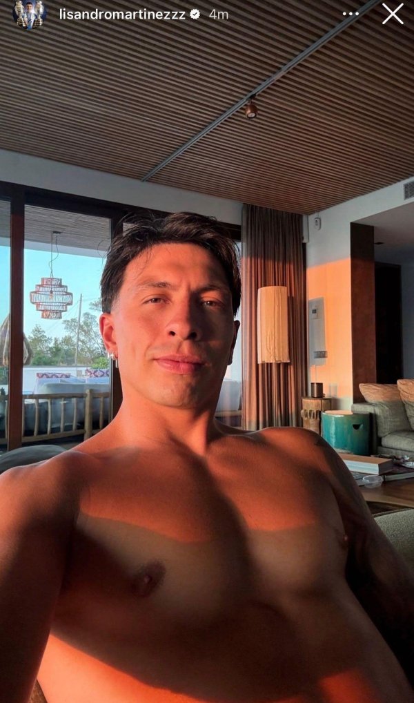 高开网 利马定下曼联复出目标，欲提前复出战两队！为长期伤缺遭质疑失望